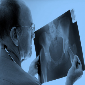 U.S. Orthopedic Imaging Modalities and Orthopedic Surgical Navigation Systems Market 