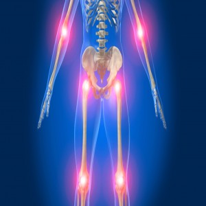Global Next Generation Implants Market