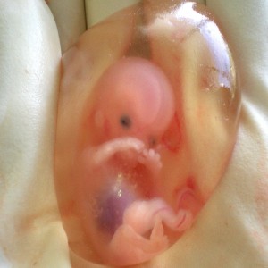 Global Prenatal Testing and Newborn Screening Market