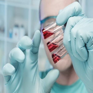 APAC Cell and Gene Therapy Biomanufacturing Market 