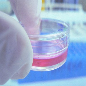 Regenerative Medicine Market