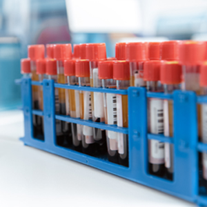 Hematologic Malignancies Testing Market