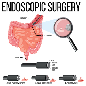 Laparoscopy and Endoscopy Devices Market News