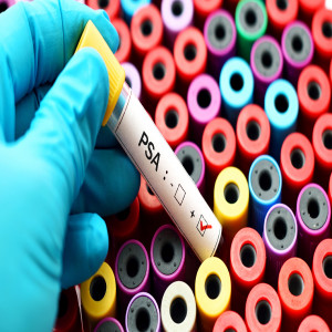 Prostate Cancer Screening Device