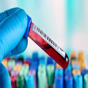 Multicancer Early Detection Screening Test