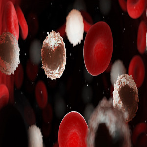 FLT3 Therapeutics