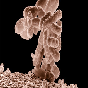 Microbiome Therapeutics Market