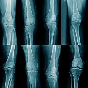 Dry X-ray film Market
