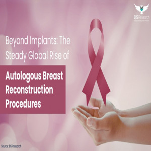 Beyond Implants - The Steady Global Rise of Autologous Breast Reconstruction Procedures
