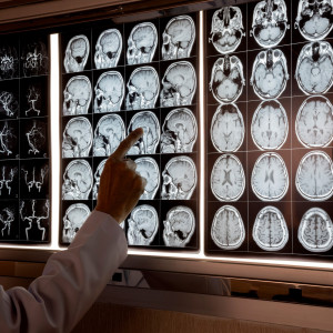 Medical X-Ray Detectors Market 