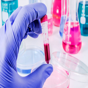 Europe Infectious Disease Diagnostics Market