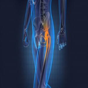 Global Orthopedics Devices Market